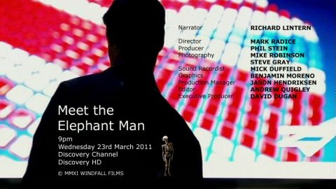 Discovery Channel – Meet the Elephant Man
