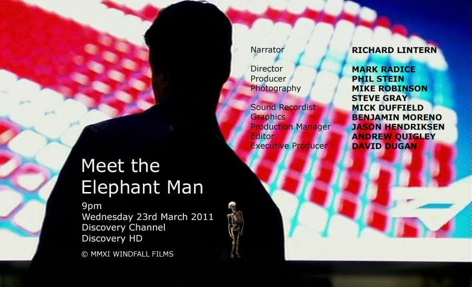3D sculpture for “Meet the Elephant Man” Discovery Channel Film